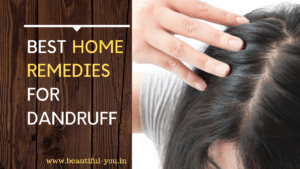 How to Remove Dandruff 5 Dandruff Home Remedies