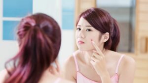 Read more about the article How to Get Rid of Red Acne Scars and Pimples?
