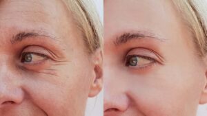 Read more about the article Wrinkles on Face: Easy Natural Homemade Remedies