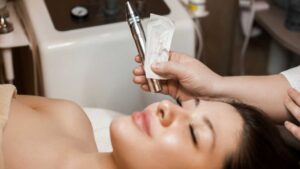 Microneedling for Rosacea: A Promising Treatment Option