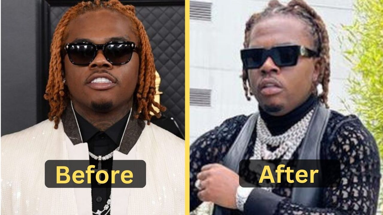 Gunna's Weight Loss: Diet Plan, Workout, Surgery, Before & After