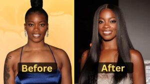 Ari Lennox's Weight Loss: Diet Plan, Workout, Surgery, Before & After