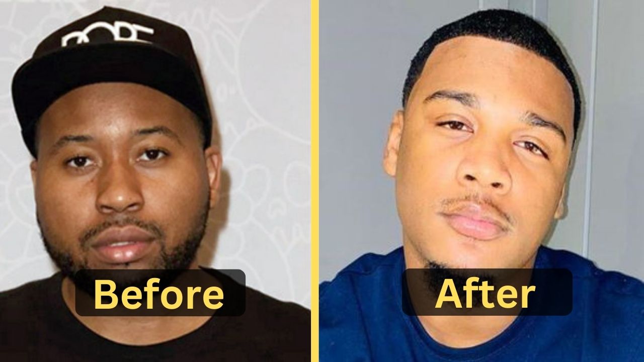 Armon Warren's Weight Loss: Diet Plan, Workout, Surgery, Before & After