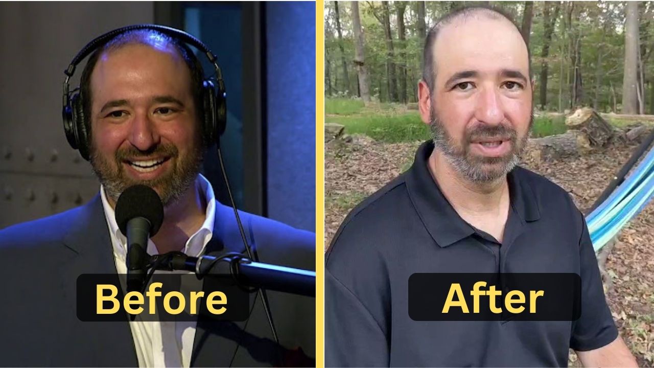 Jason Kaplan's Weight Loss: Diet Plan, Workout, Surgery, Before & After