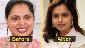 Maneet Chauhan's Weight Loss: Diet Plan, Workout, Surgery Before & After
