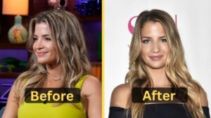 Naomie Olindo's Weight Loss: Diet Plan, Workout, Surgery, Before & After