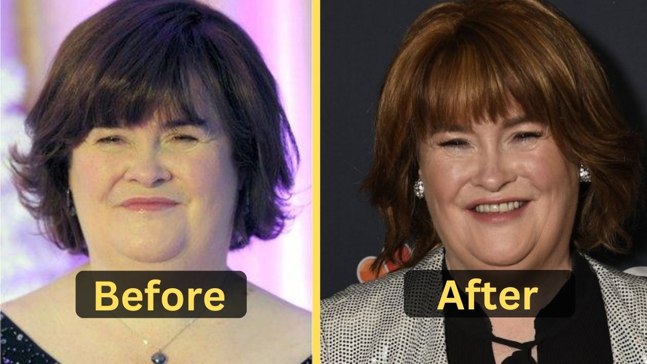 Susan Boyle's Weight Loss: Diet Plan, Workout, Surgery, Before & After