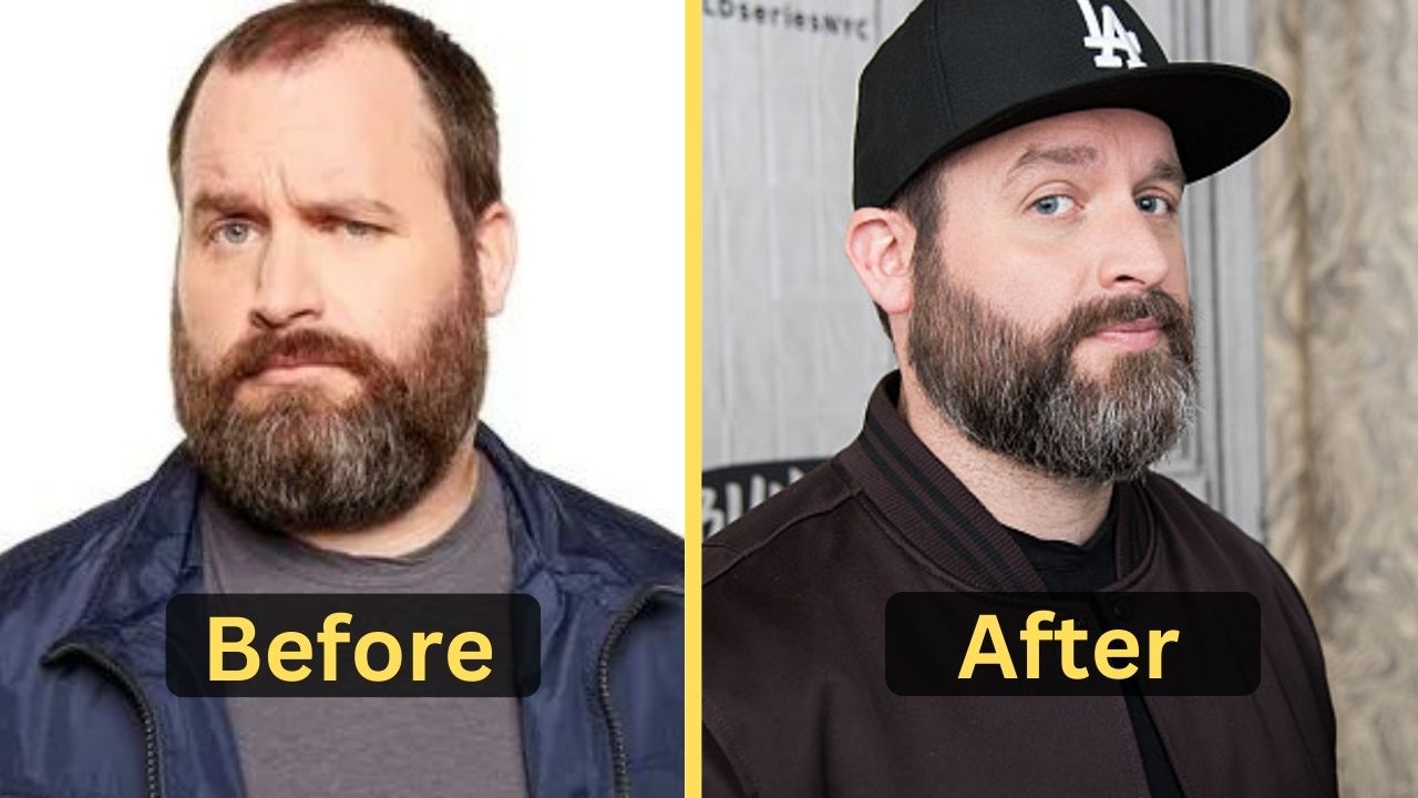 Tom Segura Weight Loss: Diet Plan, Workout, Surgery, Before & After